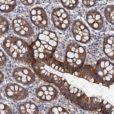 Immunohistochemistry-Paraffin: TMTC3 Antibody [NBP1-93728]