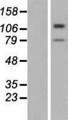 Western Blot: TMTC3 Overexpression Lysate [NBP2-04887]