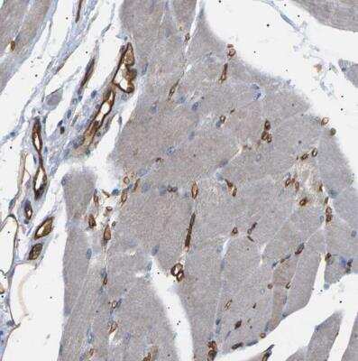 Immunohistochemistry-Paraffin: TMTC4 Antibody [NBP1-83685]