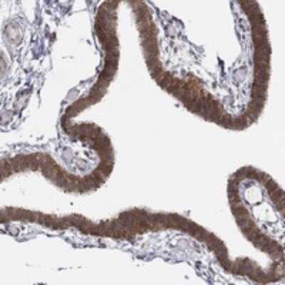 Immunohistochemistry-Paraffin: TMTC4 Antibody [NBP3-17447]