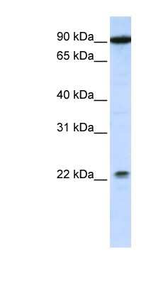 Western Blot: TMTC4 Antibody [NBP1-59824]