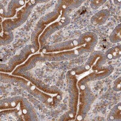 Immunohistochemistry-Paraffin: TMUB1 Antibody [NBP1-86731]