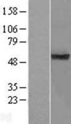 Western Blot: TMUB1 Overexpression Lysate [NBP2-06128]