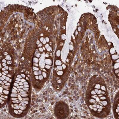 Immunohistochemistry-Paraffin: TMUB2 Antibody [NBP1-81129]