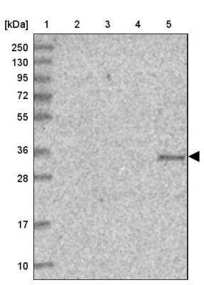 Western Blot: TMUB2 Antibody [NBP1-81129]