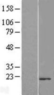 Western Blot: TMUB2 Overexpression Lysate [NBL1-17133]