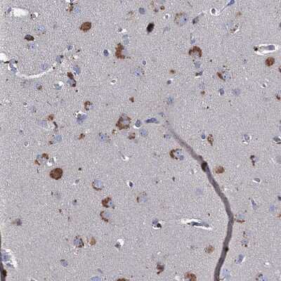 Immunohistochemistry-Paraffin: TMX2 Antibody [NBP1-87305]