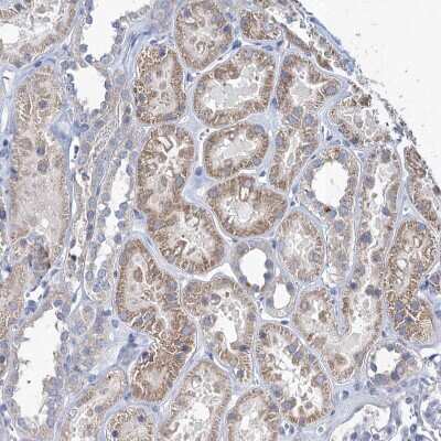 Immunohistochemistry-Paraffin: TMX2 Antibody [NBP1-87305]