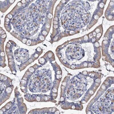 Immunohistochemistry-Paraffin: TMX2 Antibody [NBP1-87305]