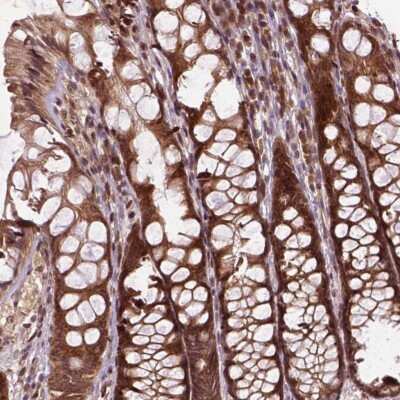 Immunohistochemistry-Paraffin: TMX2 Antibody [NBP2-49405]