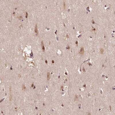 Immunohistochemistry-Paraffin: TMX2 Antibody [NBP2-49405]