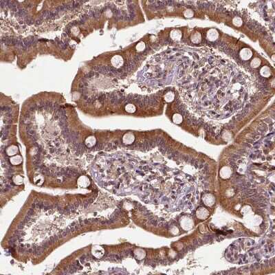 Immunohistochemistry-Paraffin: TMX2 Antibody [NBP2-49405]