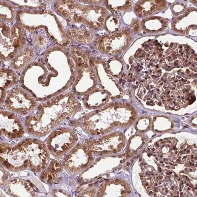 Immunohistochemistry-Paraffin: TMX2 Antibody [NBP2-49405]