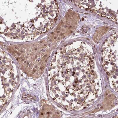 Immunohistochemistry-Paraffin: TMX2 Antibody [NBP2-49405]