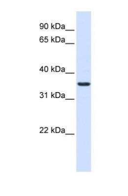 Western Blot: TMX2 Antibody [NBP1-69586]