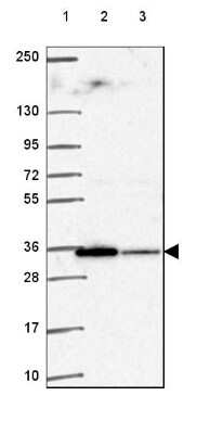 Western Blot: TMX2 Antibody [NBP2-49405]