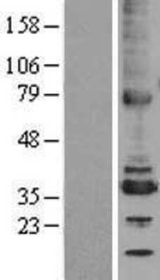 Western Blot: TMX2 Overexpression Lysate [NBL1-17467]