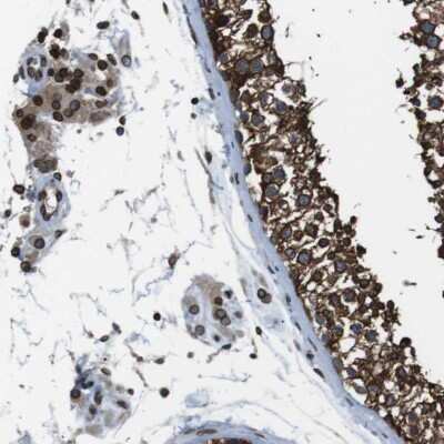 Immunohistochemistry-Paraffin: TMX4 Antibody [NBP1-85158]