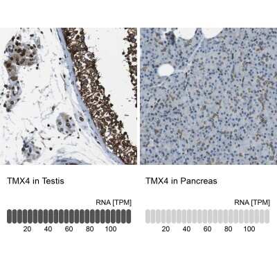 Immunohistochemistry-Paraffin: TMX4 Antibody [NBP1-85158]