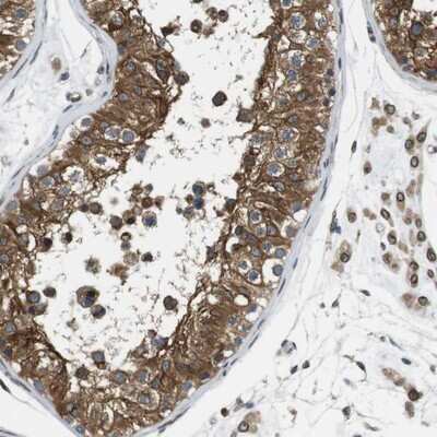 Immunohistochemistry-Paraffin: TMX4 Antibody [NBP1-85159]