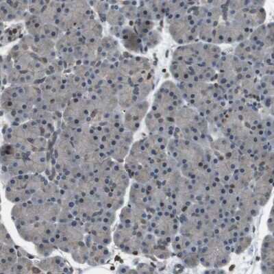 Immunohistochemistry-Paraffin: TMX4 Antibody [NBP1-85159]