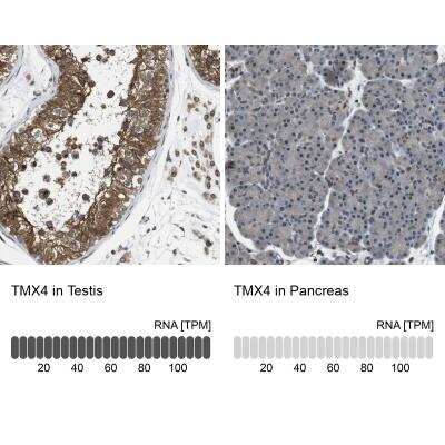 Immunohistochemistry-Paraffin: TMX4 Antibody [NBP1-85159]