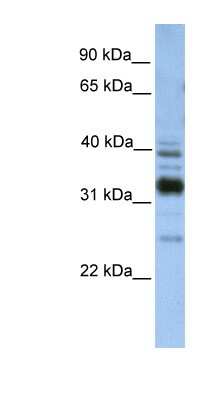 Western Blot: TMX4 Antibody [NBP1-62600]