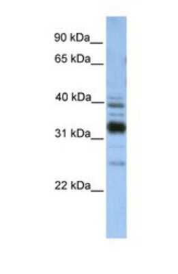 Western Blot: TMX4 Antibody [NBP1-69606]