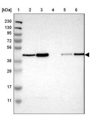 Western Blot: TMX4 Antibody [NBP1-85158]