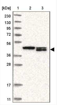 Western Blot: TMX4 Antibody [NBP1-85159]
