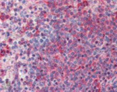 Immunohistochemistry-Paraffin: TNF RI/TNFRSF1A Antibody [NBP1-97453]