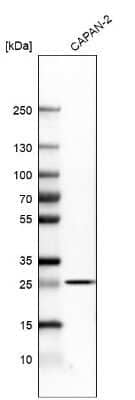 Western Blot: TNF RI/TNFRSF1A Antibody [NBP1-88140]