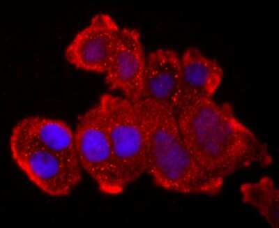 Immunocytochemistry/ Immunofluorescence: TNF RII/TNFRSF1B Antibody (JM113-01) [NBP2-67218]
