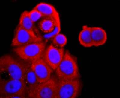 Immunocytochemistry/ Immunofluorescence: TNF RII/TNFRSF1B Antibody (JM113-01) [NBP2-67218]