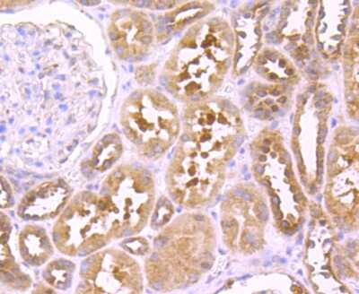 Immunohistochemistry-Paraffin: TNF RII/TNFRSF1B Antibody (JM113-01) [NBP2-67218]