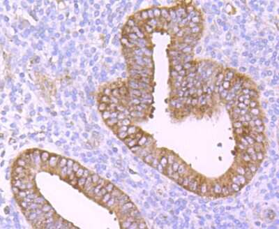 Immunohistochemistry-Paraffin: TNF RII/TNFRSF1B Antibody (JM113-01) [NBP2-67218]