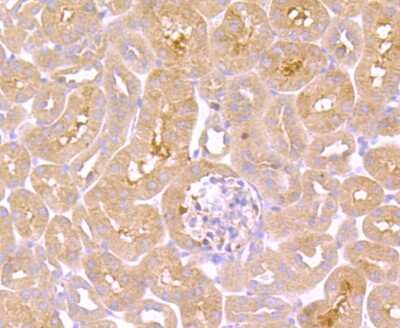 Immunohistochemistry-Paraffin: TNF RII/TNFRSF1B Antibody (JM113-01) [NBP2-67218]