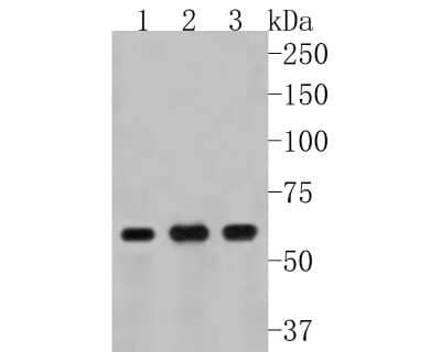 Western Blot: TNF RII/TNFRSF1B Antibody (JM113-01) [NBP2-67218]