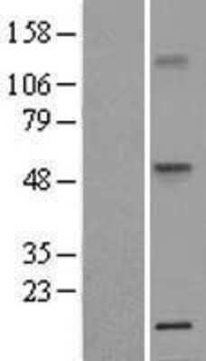 Western Blot: TNF RI/TNFRSF1A Overexpression Lysate [NBL1-17154]