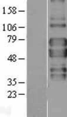 Western Blot: TNF RII/TNFRSF1B Overexpression Lysate [NBL1-17155]