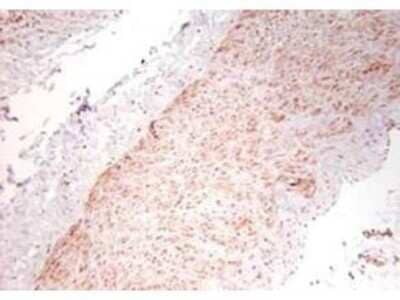 Immunohistochemistry: TNF-alpha Antibody - Azide Free [NB600-587]