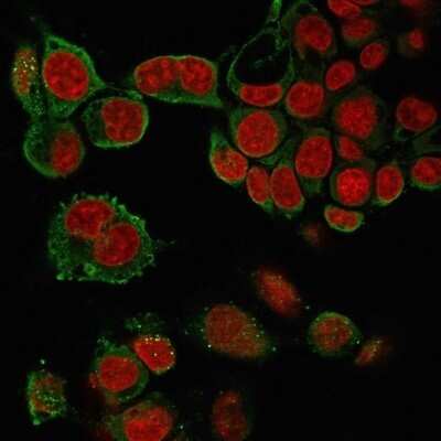 Immunocytochemistry/ Immunofluorescence: TNF-alpha Antibody (4C6-H8) - Azide and BSA Free [NBP2-34539]