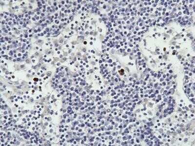 Immunohistochemistry: TNF-alpha Antibody (52B83) - BSA Free [NBP2-48484]