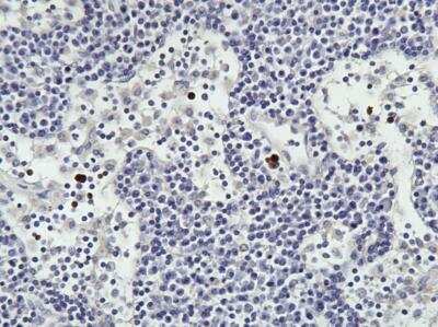 Immunohistochemistry-Paraffin: TNF-alpha Antibody (52B83) [NB600-1422]