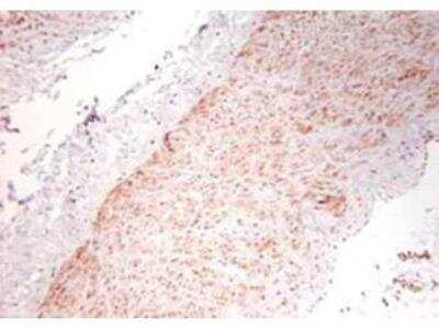 Immunohistochemistry: TNF-alpha Antibody [NBP2-44062]
