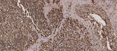 Immunohistochemistry: TNF-alpha Antibody [NBP2-44062]