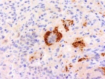 Immunohistochemistry-Paraffin: TNF-alpha Antibody (P/T2) [NBP2-34302]