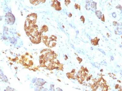 Immunohistochemistry-Paraffin: TNF-alpha Antibody (P/T2) [NBP2-34302]