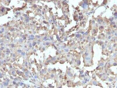 Immunohistochemistry-Paraffin: TNF-alpha Antibody (TNF/1500R) - Azide and BSA Free [NBP3-11621]