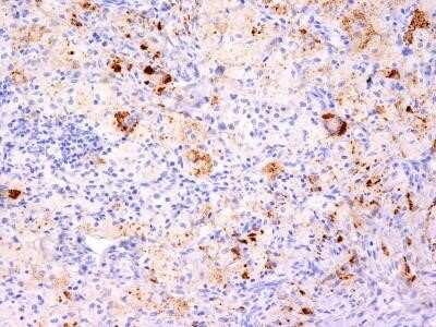 Immunohistochemistry-Paraffin: TNF-alpha Antibody (TNF706 + P/T2) - Azide and BSA Free [NBP2-34729]
